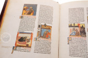 Abu´l Qasim Halaf ibn Abbas al-Zahraui - Chirurgia, Vienna, Österreichische Nationalbibliothek, Codex Vindobonensis S. N. 2641 − Photo 10