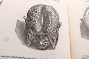 Andreas Vesalius: De Humani Corporis Fabrica, London, British Library, 548.i.2.(1) − Photo 19